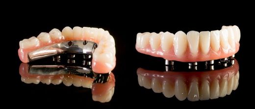 Protez Çeşitleri Nelerdir?